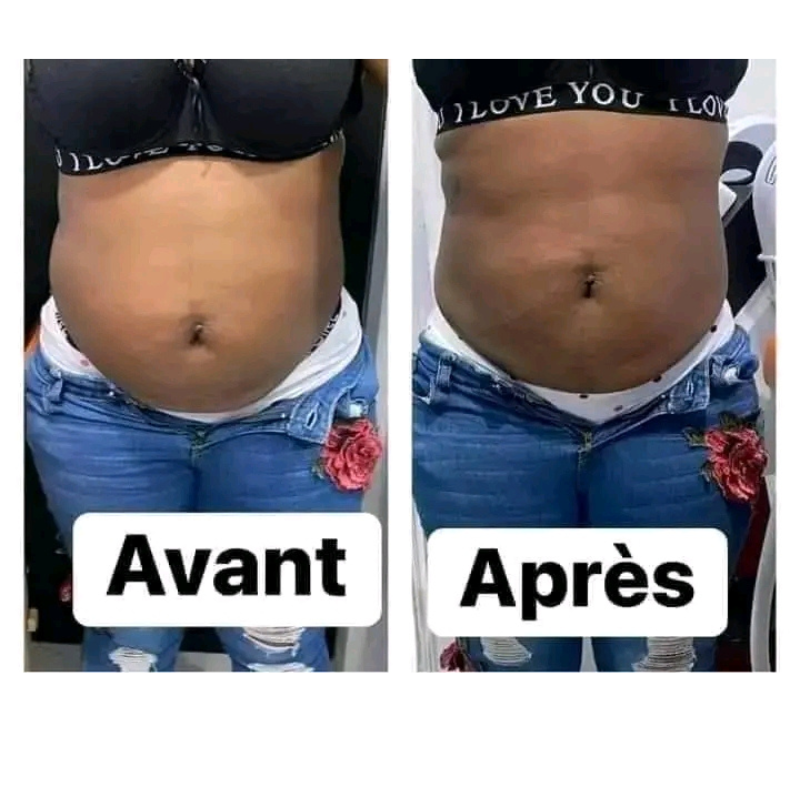 ✅ Slim Patch : minceur & brûle-graisse & amincissant (1 carton acheté =1 carton offert)