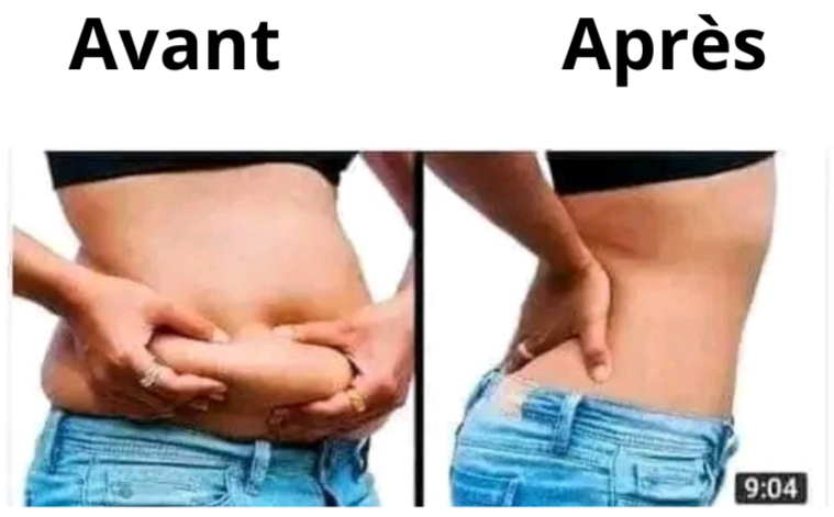 ✅ Slim Patch : minceur & brûle-graisse & amincissant (1 carton acheté =1 carton offert)